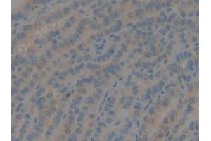 DAB staining on IHC-P; Samples: Human Thyroid Tissue (GDF10 Antikörper  (AA 337-477))
