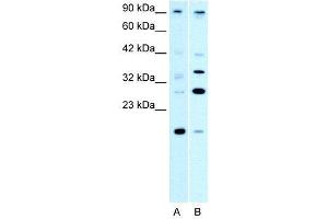 WB Suggested Anti-PARP11  Antibody Titration: 0. (PARP11 Antikörper  (N-Term))