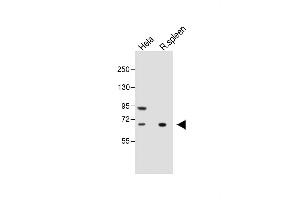 All lanes : Anti-ALOX12 Antibody (C-term) at 1:1000 dilution Lane 1: Hela whole cell lysate Lane 2: Rat spleen whole tissue lysate Lysates/proteins at 20 μg per lane.