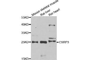 Western blot analysis of extracts of various cell lines, using CSRP3 antibody. (CSRP3 Antikörper)