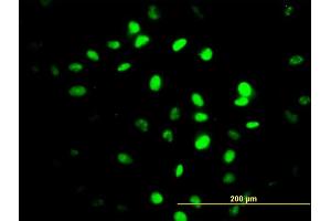 Immunofluorescence of monoclonal antibody to ZNF24 on HeLa cell. (ZNF24 Antikörper  (AA 1-368))