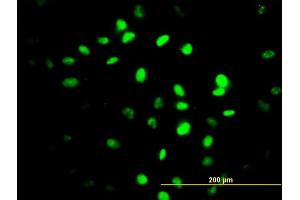 Immunofluorescence of monoclonal antibody to ZNF24 on HeLa cell. (ZNF24 Antikörper  (AA 1-368))