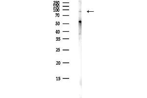 anti-TRM1 tRNA Methyltransferase 1-Like (TRMT1L) antibody