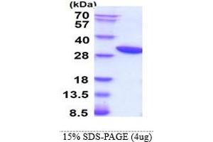 SDS-PAGE (SDS) image for Heme Oxygenase (Decycling) 1 (HMOX1) (AA 1-266) protein (His tag) (ABIN666727)
