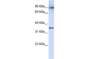 WB Suggested Anti-LRRC59 Antibody Titration:  1 ug/ml  Positive Control:  Fetal Lung cell lysate (LRRC59 Antikörper  (N-Term))