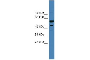 WB Suggested Anti-SERPINB2 Antibody Titration: 0. (SERPINB2 Antikörper  (Middle Region))