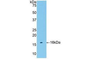 Western blot analysis of recombinant Human TMEM27. (TMEM27 Antikörper  (AA 17-137))