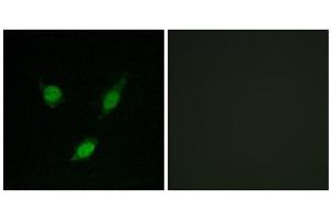 Immunofluorescence analysis of MCF-7 cells, using TACC1 antibody. (TACC1 Antikörper  (N-Term))