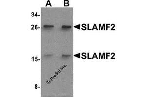Western Blotting (WB) image for anti-CD48 (CD48) (Middle Region) antibody (ABIN1031096) (CD48 Antikörper  (Middle Region))