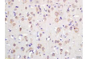 Formalin-fixed and paraffin embedded rat brain labeled with Rabbit Anti-TSPAN12 Polyclonal Antibody, Unconjugated (ABIN2179830) at 1:200 followed by conjugation to the secondary antibody and DAB staining (TSPAN12 Antikörper  (AA 1-100))