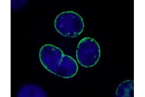 Immunofluorescence (IF) image for anti-Nucleoprotein TPR (TPR) (C-Term) antibody (ABIN7448922) (TPR Antikörper  (C-Term))