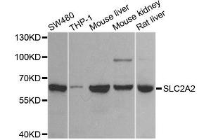 Western blot analysis of extracts of various cell lines, using SLC2A2 antibody (ABIN6003575) at 1/1000 dilution. (SLC2A2 Antikörper)