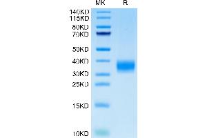 Cynomolgus LAMP5 on Tris-Bis PAGE under reduced condition. (LAMP5 Protein (AA 30-235) (His tag))