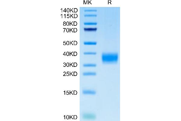 LAMP5 Protein (AA 30-235) (His tag)
