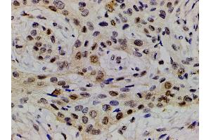 Immunohistochemistry (IHC) image for anti-LIM Domain Kinase 1 (LIMK1) (pThr508) antibody (ABIN6255701)