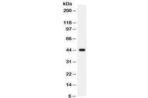 Western blot testing of human 22RV1 cell lysate with WNT2B antibody. (WNT2B Antikörper)
