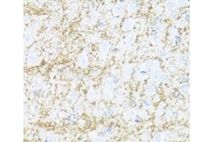 Immunohistochemistry of paraffin-embedded Rat brain using CNP Polyclonal Antibody at dilution of 1:100 (40x lens). (Cnpase Antikörper)