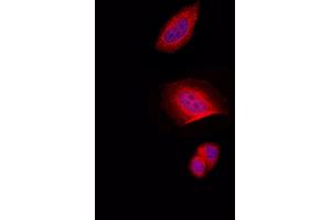 ABIN6257707 and ABIN6274332 staining Hela by IF/ICC. (CHAF1B Antikörper  (N-Term))
