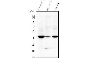 Western blot analysis of TMEM255B using anti-TMEM255B antibody (ABIN7600444). (TMEM255B Antikörper  (AA 196-240))