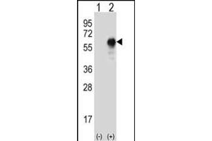 Western blot analysis of LZP (arrow) using rabbit polyclonal LZP Antibody (ABIN655394 and ABIN2844942).