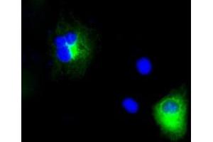 Image no. 3 for anti-Amyloid beta (A4) Precursor Protein (APP) antibody (ABIN1496880) (APP Antikörper)