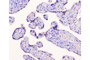 IHC analysis of AES using anti-AES antibody (ABIN6719264). (AES Antikörper  (AA 69-138))