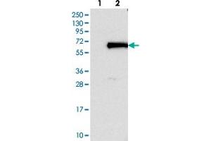 Western blot analysis of Lane 1: Negative control (vector only transfected HEK293T lysate). (FOXN2 Antikörper)