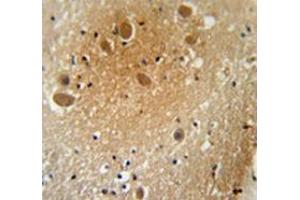 Immunohistochemistry analysis in human brain tissue (Formalin-fixed, Paraffin-embedded) using SPARCL1 / Hevin  Antibody , followed by peroxidase conjugation of the secondary antibody and DAB staining. (SPARCL1 Antikörper  (Middle Region))