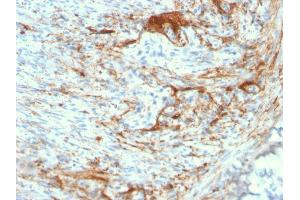 Formalin-fixed, paraffin-embedded human Small Intestine stained with Rabbit Recombinant Monoclonal Antibody (ELN/3131R) to Elastin. (Rekombinanter Elastin Antikörper)