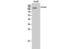 Western Blotting (WB) image for anti-Collagen, Type IX, alpha 1 (COL9A1) (Internal Region) antibody (ABIN3184026)