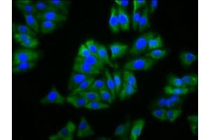Immunofluorescence staining of HepG2 cells with ABIN7163038 at 1:133, counter-stained with DAPI. (BFSP2 Antikörper  (AA 11-110))