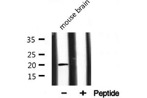 Western blot analysis of JM4 expression in mouse brain lysate