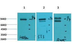 Western Blotting (WB) image for anti-Signal Transducer and Activator of Transcription 1, 91kDa (STAT1) antibody (ABIN3179107) (STAT1 Antikörper)