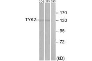 Western blot analysis of extracts from 293/COS7 cells, treated with heat shock, using TYK2 (Ab-1054) Antibody. (TYK2 Antikörper  (AA 1020-1069))