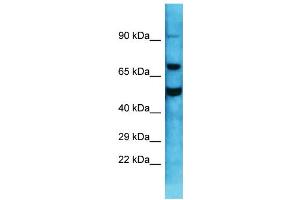 Host: Rabbit  Target Name: Gnl1  Sample Tissue: Mouse Testis lysates  Antibody Dilution: 1. (GNL1 Antikörper  (C-Term))