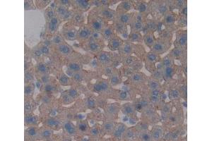 Used in DAB staining on fromalin fixed paraffin- embedded liver tissue (ABCB4 Antikörper  (AA 1034-1276))