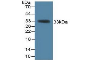 Western blot analysis of recombinant Mouse KHDRBS1. (KHDRBS1 Antikörper  (AA 156-381))