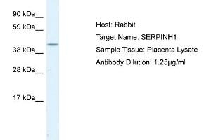 Image no. 1 for anti-Serpin Family H Member 1 (SERPINH1) (C-Term) antibody (ABIN2792207) (SERPINH1 Antikörper  (C-Term))