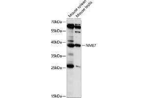 Western blot analysis of extracts of various cell lines, using NME7 antibody (ABIN7269055) at 1:1000 dilution. (NME7 Antikörper  (AA 1-376))