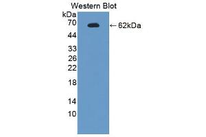Western blot analysis of the recombinant protein. (Endonuclease G Antikörper  (AA 1-294))
