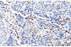 Immunohistochemistry of paraffin-embedded Mouse spleen using S100A9 Polyclonal Antibody at dilution of 1:100 (40x lens). (S100A9 Antikörper)