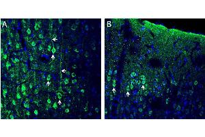 Expression of CX3CL1 in rat frontal cortexImmunohistochemical staining of perfusion-fixed frozen rat brain sections with Anti-CX3CL1 (extracellular) Antibody (ABIN7043045, ABIN7044192 and ABIN7044193), (1:200), followed by goat anti-rabbit-AlexaFluor-488. (Chemokine (C-X3-C Motif) Ligand 1 (CX3CL1) Peptid)