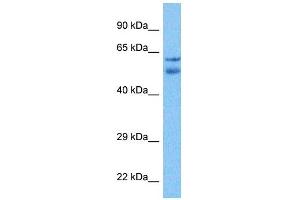 Host:  Rabbit  Target Name:  TTC6  Sample Tissue:  Liver Tumor lysates  Antibody Dilution:  1ug/ml (TTC6 Antikörper  (N-Term))