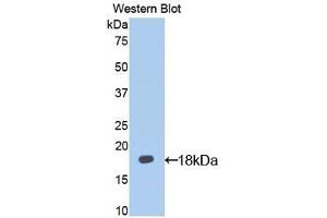 Detection of Recombinant IL13Ra1, Mouse using Polyclonal Antibody to Interleukin 13 Receptor Alpha 1 (IL13Ra1) (IL13 Receptor alpha 1 Antikörper  (AA 28-171))