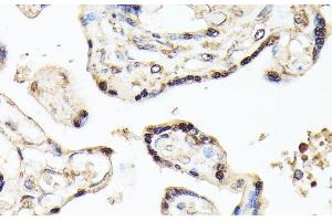 Immunohistochemistry of paraffin-embedded Human placenta using KLF5 Polyclonal Antibody at dilution of 1:100 (40x lens). (KLF5 Antikörper)