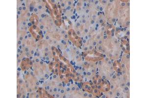 IHC-P analysis of kidney tissue, with DAB staining. (AFAP Antikörper  (AA 352-572))