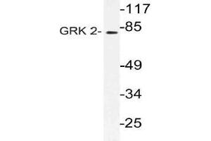 Western blot (WB) analysis of GRK 2 antibody in extracts from Jurkat cells. (GRK2 Antikörper)