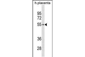 TARBP2 Antibody (N-term) ABIN2846967 western blot analysis in human placenta tissue lysates (35 μg/lane). (TARBP2 Antikörper  (N-Term))