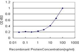 Detection limit for recombinant GST tagged CBR1 is approximately 1ng/ml as a capture antibody. (CBR1 Antikörper  (AA 1-277))