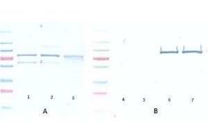 Western Blotting (WB) image for anti-V-Akt Murine Thymoma Viral Oncogene Homolog 1 (AKT1) (Ser473) antibody (ABIN400784) (AKT1 Antikörper  (Ser473))